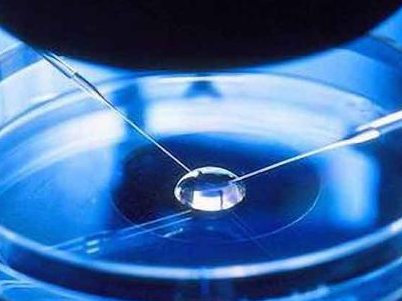 厦门二胎高龄孕前检查项目表