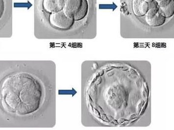新乡试管医院排名前5汇总单揭秘，本地姐妹告诉你答案
